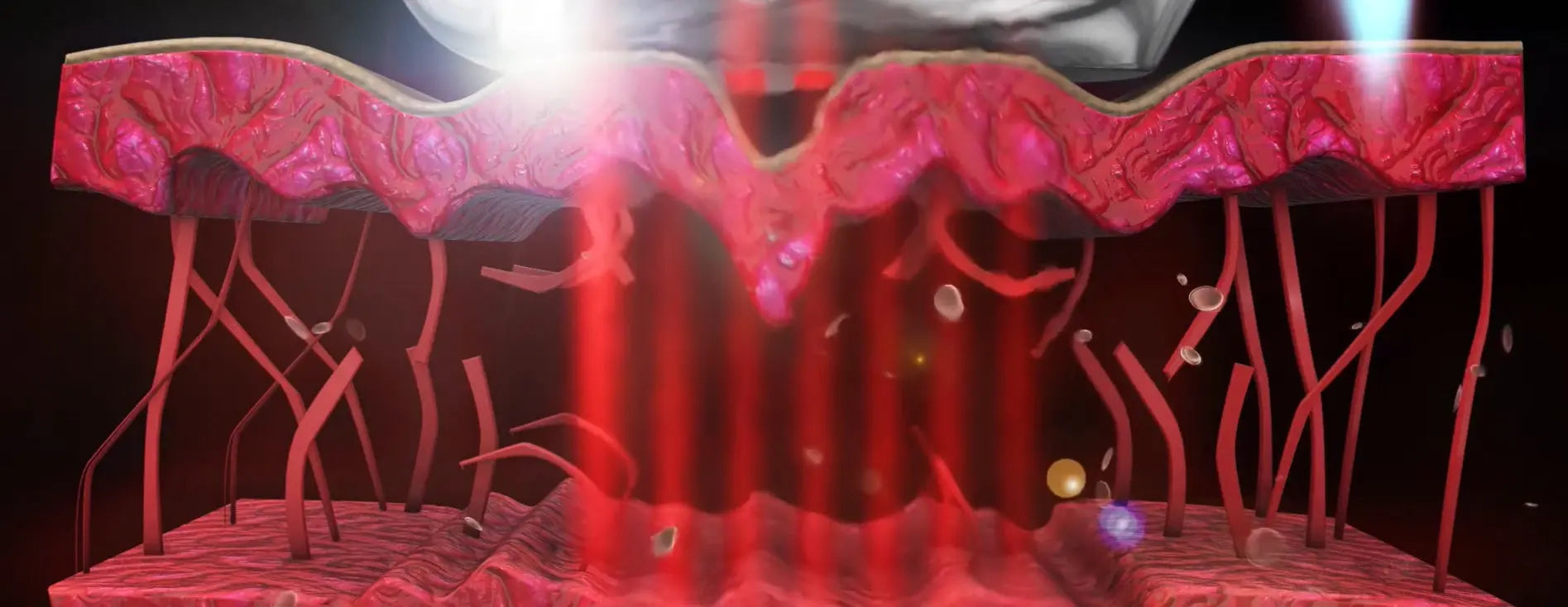 Pulsed-InfraRed myernk
