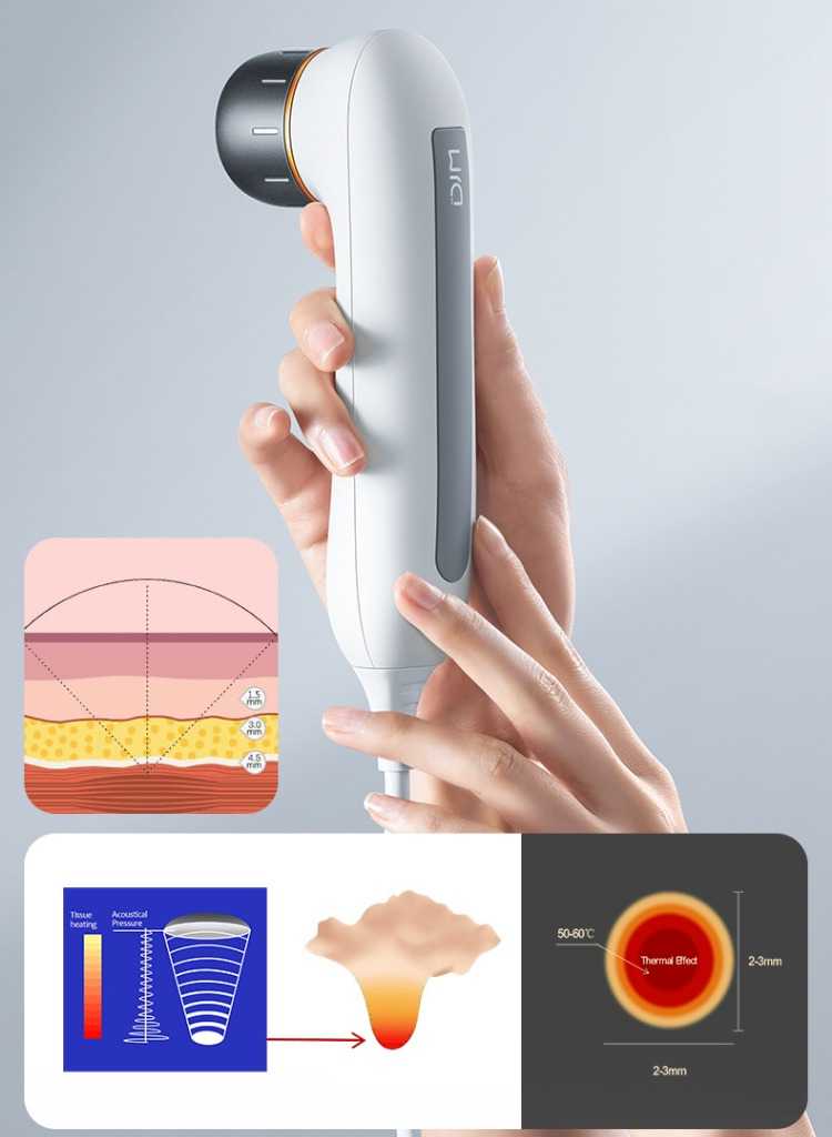 DJM Ultrasonic Cannon Anti-Aging RF Beauty Device myernk